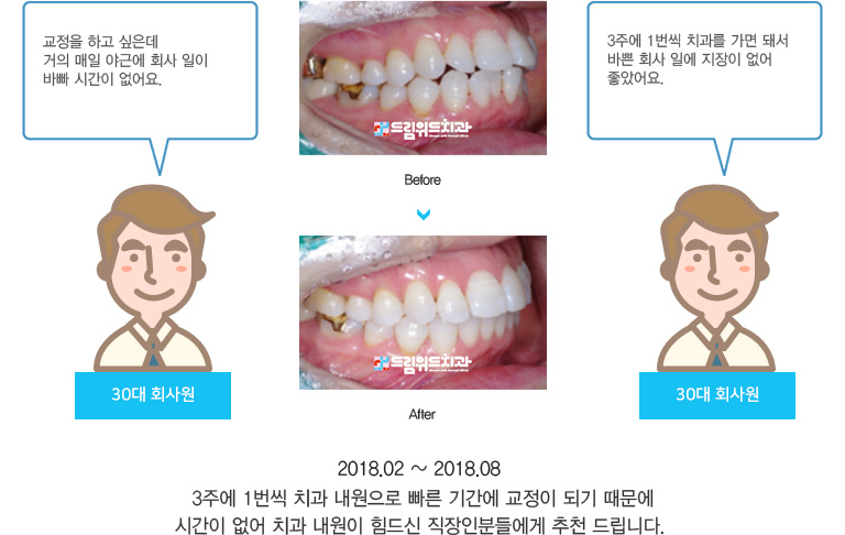 3주에 1번씩 치과 내원으로 빠른 기간에 교정이 되기 때문에
시간이 없어 치과 내원이 힘드신 직장인분들에게 추천 드립니다. 